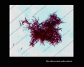acid-fast stained mycobacterial culture specimen